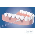 Зубная нить Foramen ORTHODONTIC DENTAL — изображение 3